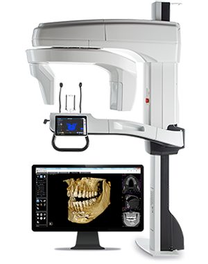 a photograph of a Carestream 9600 CBCT with an insert of a computer screen showing a jaw imaged by the device